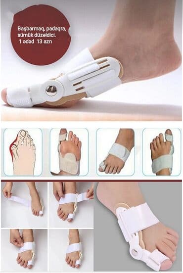 padaqra ucun silikon: Padaqranı mualice eden ve agrinin qarşisini alan fiksator. Silikon — 2