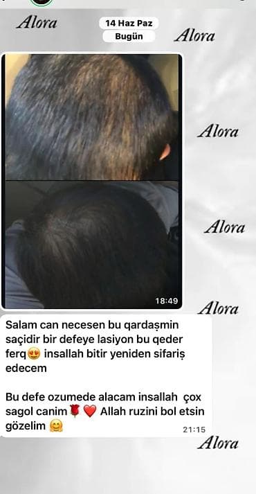 TƏBİİ SAÇ BAXIM SETİ! 🌿 Saç tökülməsi, zəif və gec uzanan saçlardan — 2