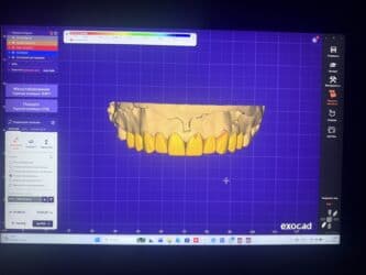 qaynaq saclarin qiymeti: Услуга зубного техника и зуботехнической лаборатории выполняю все — 1