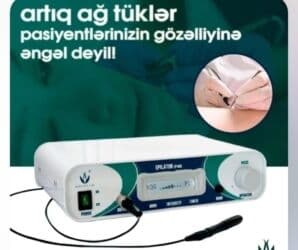 ikinci el orient saat: Lazer aparatı "epiray" — 1