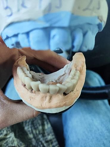 Услуги: Diş texnikliyi kursları(6 ay erzinde tam öyredilir, stomotoloji — 9