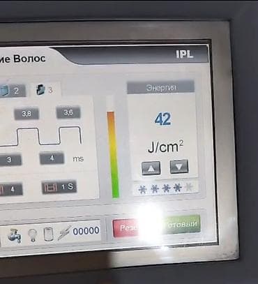 lazer e: Epilyasiya üçün — 2