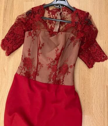 сони на прокат: 1 defe geyinilib . korsetledir . 100azn . 1500azn tikilib — 3