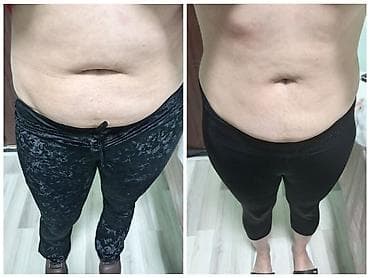 hekim sekli: Estetik xidmətlər: üz və bədən üçün qeyri‑invaziv kontur formalaşdırma — 4