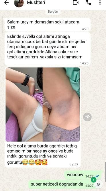 saat destleri: Qolaltı qaralma və ləkələr üçün ağardırıcı baxım seti Məhsulun — 4