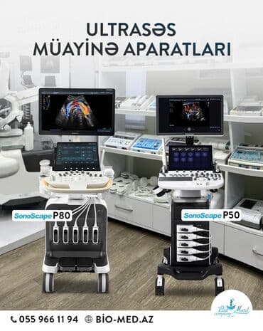 Нитриловые перчатки: Sonoscape P50 & P80 – Premium görüntüləmə artıq daha əlçatan! — 2