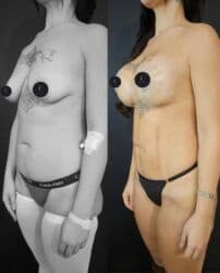 dermapen qiymeti: Plastik estetik hər yüksək səviyyə uyğun qiymət!!!Burdan mesaj — 10