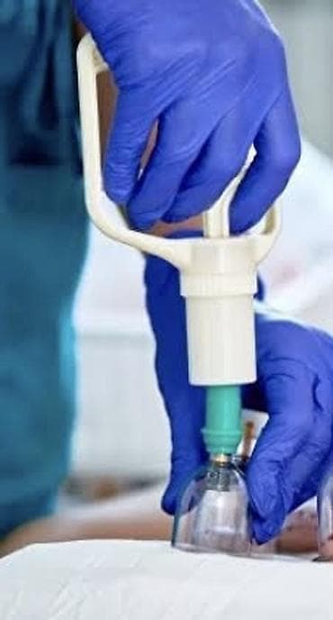 Hicama teropiya, evimdə hicama 60azn, çıxış şəhərə 100azn lalafo.az -da Hicama teropiya, evimdə hicama 60azn, çıxış şəhərə 100azn