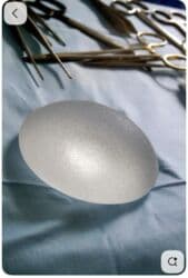 dermapen qiymeti: Plastik estetik hər yüksək səviyyə uyğun qiymət!!!Burdan mesaj — 9