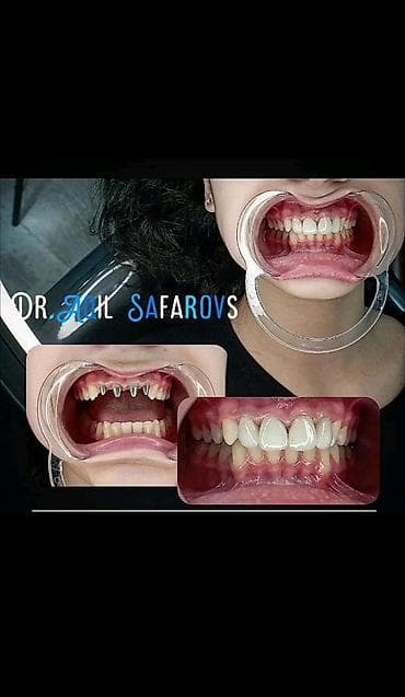 Ремонт техники: Stomatolojı Klinika Dentalux– təbii görünüşlü, parlaq gülümsəmə - — 9