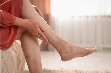 Varikoz müalicəsi, Evə gəlməklə, Klinikada