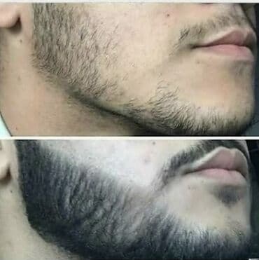 qaş və kirpiklər üçün baxım: Məhsul: Beard Oil – 100% natural/organic, 30 ml Təsvir: - Saqqal və — 4