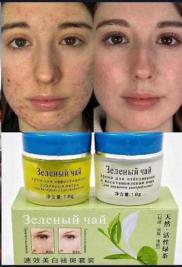 a e vitamini krem: Yawil cay kremi uzdeki lekeleri aparir, derini cavanlasdirir — 1