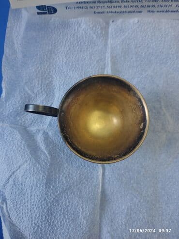 qədim radio: Antik əşya(siqanka) 100 ildən çox yaşı var( qarşıq tərkib( brunc — 2