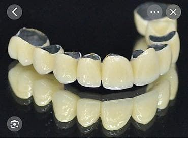 Metal keramika alıram ağza girib çıxmış olmalıdır 15 azn 100 qram