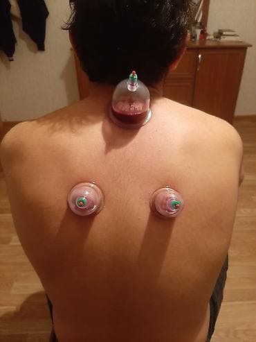 Hicama,Masaj! Hər xəstəlikdən hicama! Vakumla masaj! lalafo.az -da Hicama,Masaj! Hər xəstəlikdən hicama! Vakumla masaj!