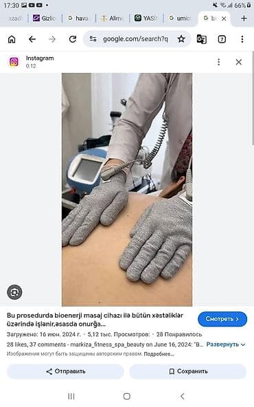 Sağlamlıq və gözəllik: Bioenerji Masajı – cihazla edilən müalicəvi prosedur yataq xesteleri — 1