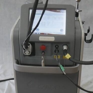 Tatto silmə, Fototerapiya üçün, Karbon pilinq, Aleksandrit, Zəmanətlə