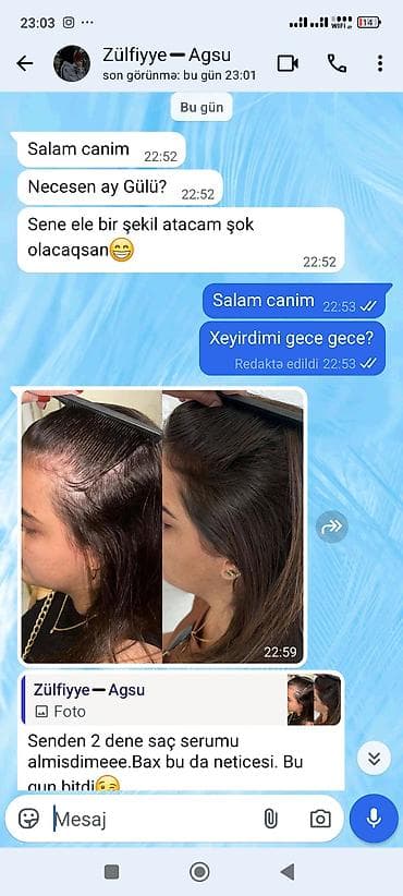 Saç Serumu – tökülmə və qırılmaya qarşı intensiv qulluq Məhsulun — 3