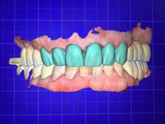 qaynaq saclarin qiymeti: Услуга зубного техника и зуботехнической лаборатории выполняю все — 2