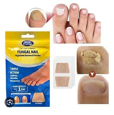 pobeda saat: Royal Prestige Fungal Nail Nighttime Renewal Patches — bu dırnaq — 1
