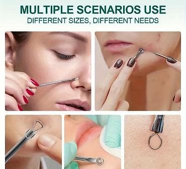 devit 3 qiyməti: Üz təmizləməsi üçün pincet ( üzdə, burun hissədə, bədən hissələrində — 1