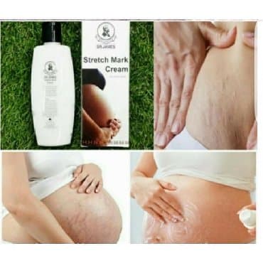 bud eritme: DR.JAMES çatlara qarşı krem Qiymət #20azn Dəri zənginləşməsinə kömək — 1