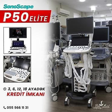 Sonoscape brendinə məxsus USM aparatı