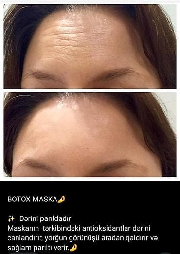 don sekilleri: Bu kremler netice superdi butun sekiller heqiqidi ve kasmetoloq — 5