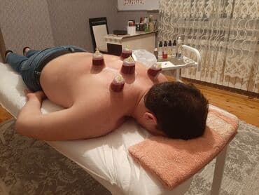 bioloji yaşam sağlamlıq mərkəzi: 📌hi̇cama nədi̇r❓ 🔷️qanalma ilə müalicə üsulu olaraq. Xəstəliklərə — 10