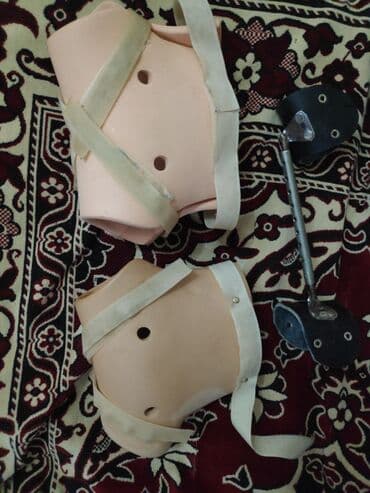 Əlil arabaları: Displaziya korseti Displaziyaya qarshi fiksator (ombadan chixish) — 1