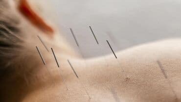 Akupunktur iynələri
Akapunktur iynəsi satışı