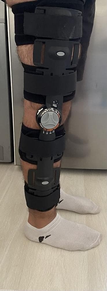 Tənzimlənən diz ortozu (immobilayzer) Özüm üçün almışam. Cəmi 1 ay — 4