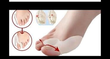 padaqra ucun silikon: Padaqranı mualice eden ve agrinin qarşisini alan fiksator. Silikon — 5