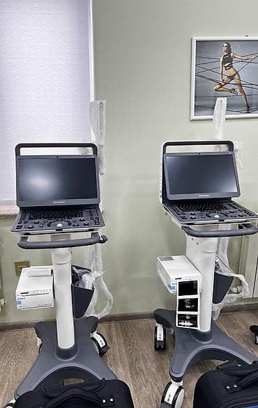 Uzi aparatlatıUSM aparatı 

SonoScape E2 və E3 uzi aparatı