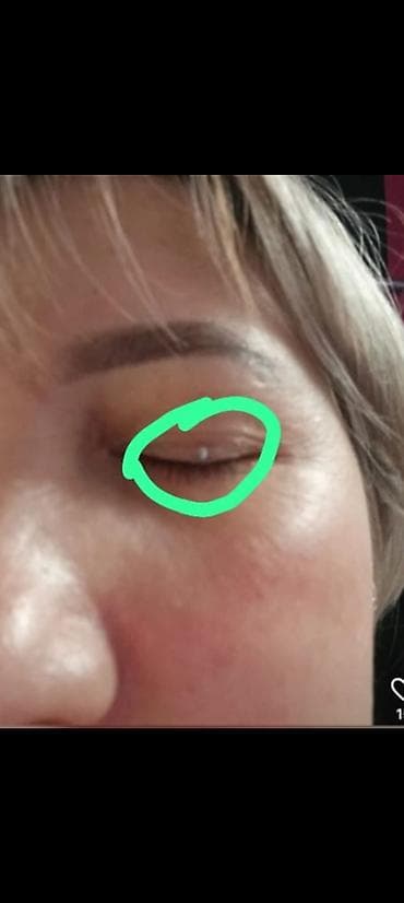 retinal krem qiymeti: Rusiyadan gelib.bedende olan ziyilleri. et xallari qurudub yox — 3