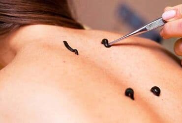 qaş formaları: Zəli satışı 🪱ibbi zeli. Səhiyyə Nazirliyi tərəfindən Azərbaycanda — 5