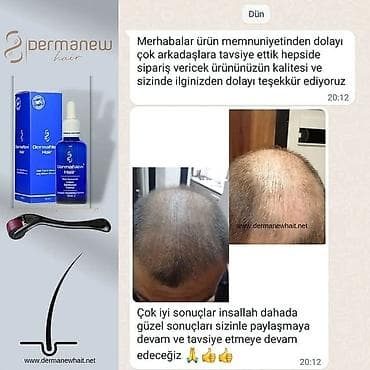 Dermanew hair saç çixaran gücləndirici Serum ilə tanış olun, köhnə