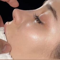 dermapen qiymeti: Plastik estetik hər yüksək səviyyə uyğun qiymət!!!Burdan mesaj — 6