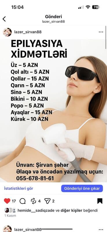saglam heyat saglamliq merkezi: Epilasiya xidmətləri – lazer üsulu ilə müxtəlif nahiyələr üçün: - Üz — 1