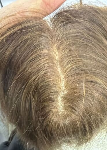 лишоу оригинал и подделка: Волосяной протез, Натуральные — 2