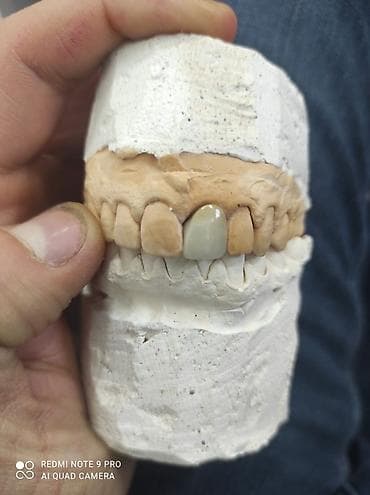 Услуги: Diş texnikliyi kursları(6 ay erzinde tam öyredilir, stomotoloji — 2
