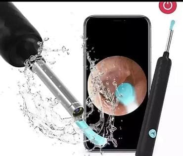 ✅Kamera ✅camera ✅Qulaq camerası ✅Kamera #tibbi kamera #mini kamera