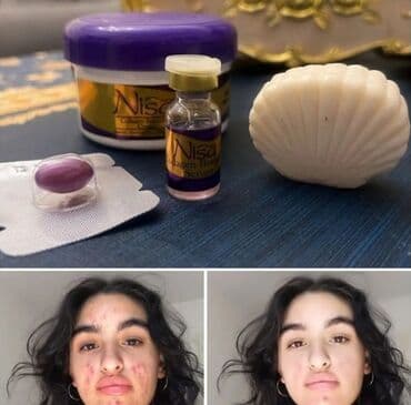 Üz kremi, Problemli dəri üçün, 20 ml, Yeni, Pulsuz çatdırılma