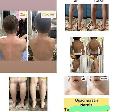 sumqayitda masaj edirem: Müalicəvi masaj, Uşaqlar üçün, Evə gəlməklə — 1
