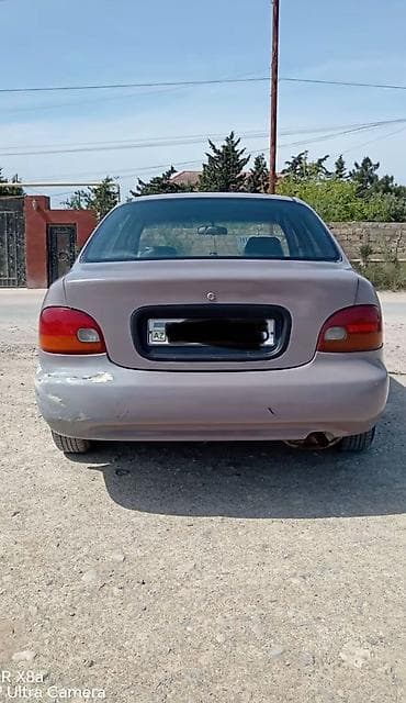 byd zapcastlari: Sökülür zapcast kimi bütün deralları var 1.3 mühərrik detalları — 4