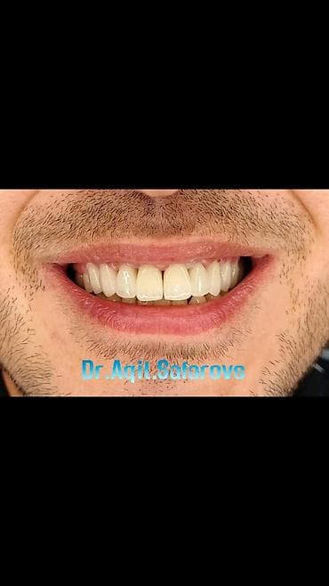 Ремонт техники: Stomatolojı Klinika Dentalux– təbii görünüşlü, parlaq gülümsəmə - — 8