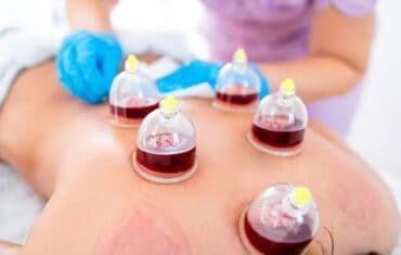 Hicama xidməti - Steril birdəfəlik vakuum bankalar və peşəkar