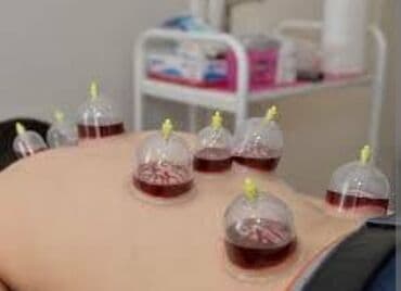 emla krem qiymeti bakida: *Hicama xidməti (evə gəlməklə)* • Baş, bel ağrılarına • Yorğunluq — 2