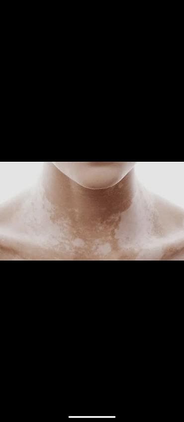 ingilis dili kursu: Dəri rənginin bərabərləşdirilməsi üçün kamuflyaj makiyaj xidməti - — 1